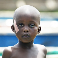 Girl with Plaster, Lake Victoria, Kenya